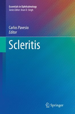 Scleritis 1