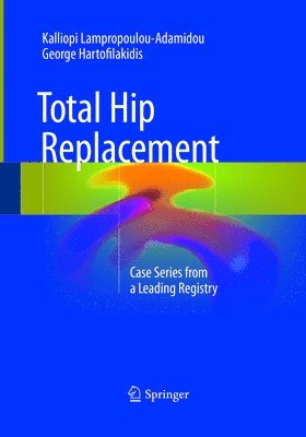 bokomslag Total Hip Replacement