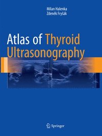 bokomslag Atlas of Thyroid Ultrasonography