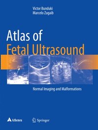 bokomslag Atlas of Fetal Ultrasound