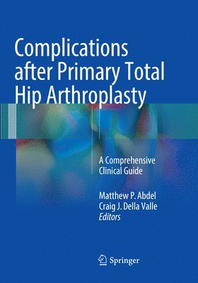 Matthew P. Abdel, Craig J. Della Valle - Complications after Primary Total Hip Arthroplasty, Häftad