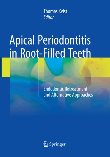 Thomas Kvist - Apical Periodontitis in Root-Filled Teeth, Häftad