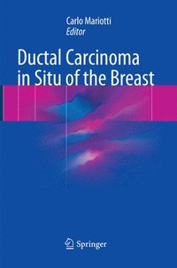 bokomslag Ductal Carcinoma in Situ of the Breast