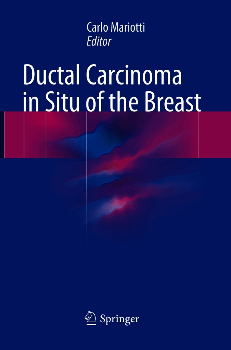 Carlo Mariotti - Ductal Carcinoma in Situ of the Breast, Häftad