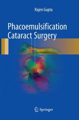 Phacoemulsification Cataract Surgery 1
