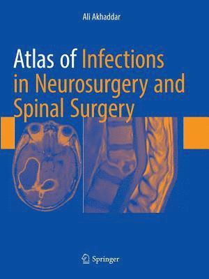 bokomslag Atlas of Infections in Neurosurgery and Spinal Surgery