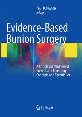 bokomslag Evidence-Based Bunion Surgery