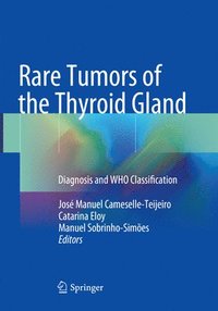 bokomslag Rare Tumors of the Thyroid Gland