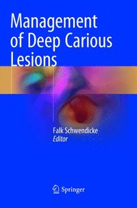 bokomslag Management of Deep Carious Lesions