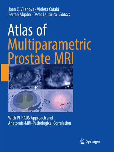 Joan C. Vilanova, Violeta Catalá, Ferran Algaba, Oscar Laucirica - Atlas of Multiparametric Prostate MRI, Häftad