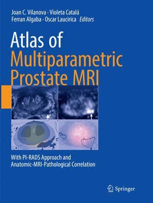 bokomslag Atlas of Multiparametric Prostate MRI