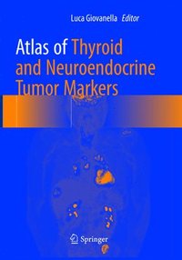 bokomslag Atlas of Thyroid and Neuroendocrine Tumor Markers