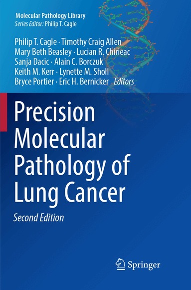 Philip T. Cagle, Timothy Craig Allen, Mary Beth Beasley, Lucian R. Chirieac, Sanja Dacic, Alain C. Borczuk, Keith M. Kerr, Lynette M. Sholl, Bryce Portier, Eric H. Bernicker - Precision Molecular Pathology of Lung Cancer, Häftad