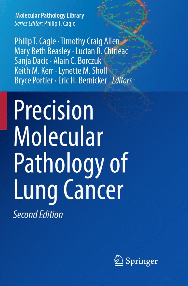 Philip T. Cagle, Timothy Craig Allen, Mary Beth Beasley, Lucian R. Chirieac, Sanja Dacic, Alain C. Borczuk, Keith M. Kerr, Lynette M. Sholl, Bryce Portier, Eric H. Bernicker, MD Sholl, Lynette M. - Precision Molecular Pathology of Lung Cancer, Häftad