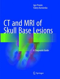 bokomslag CT and MRI of Skull Base Lesions