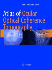 bokomslag Atlas of Ocular Optical Coherence Tomography