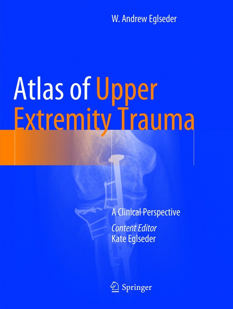 W. Andrew Eglseder - Atlas of Upper Extremity Trauma, Häftad