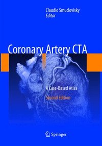 bokomslag Coronary Artery CTA