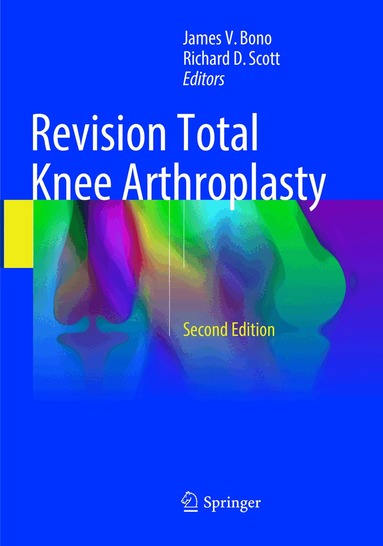 James V. Bono, Richard D. Scott - Revision Total Knee Arthroplasty, Häftad