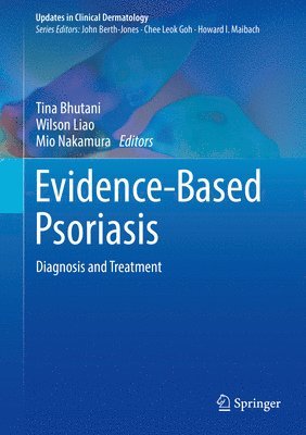Tina Bhutani, Wilson Liao, Mio Nakamura - Evidence-Based Psoriasis, Inbunden
