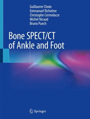 Bone SPECT/CT of Ankle and Foot 1