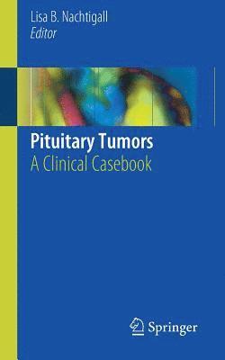 Pituitary Tumors 1