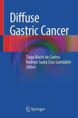 Tiago Biachi de Castria, Rodrigo Santa Cruz Guindalini - Diffuse Gastric Cancer, Häftad