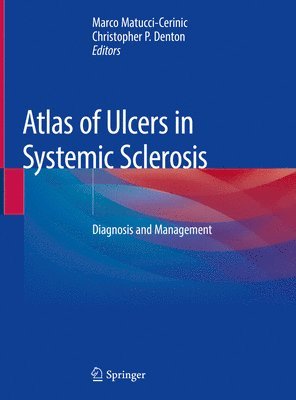 Marco Matucci-Cerinic, Christopher P. Denton - Atlas of Ulcers in Systemic Sclerosis, Inbunden