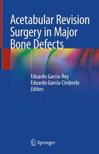 bokomslag Acetabular Revision Surgery in Major Bone Defects
