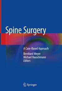 bokomslag Spine Surgery