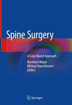 Spine Surgery 1