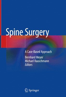 Spine Surgery