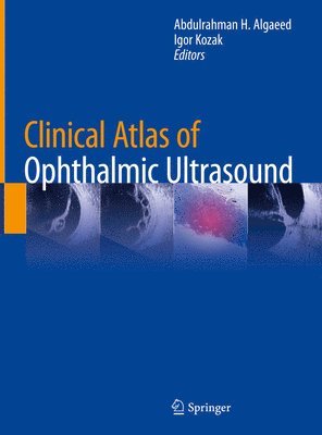 Clinical Atlas of Ophthalmic Ultrasound 1