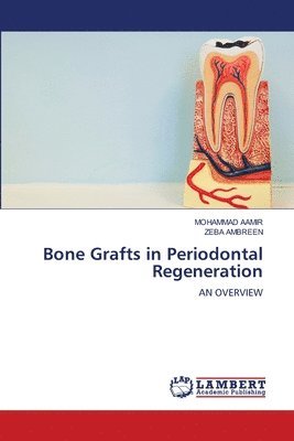 bokomslag Bone Grafts in Periodontal Regeneration