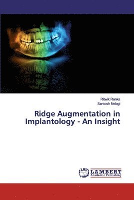 bokomslag Ridge Augmentation in Implantology - An Insight