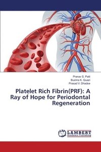 bokomslag Platelet Rich Fibrin(PRF)