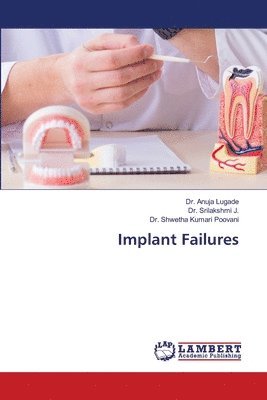 bokomslag Implant Failures