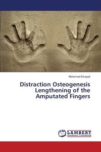 bokomslag Distraction Osteogenesis Lengthening of the Amputated Fingers