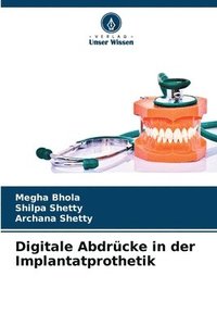 bokomslag Digitale Abdrücke in der Implantatprothetik