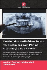 bokomslag Destino dos antibióticos locais vs. sistémicos com PRF na cicatrização do 3° molar