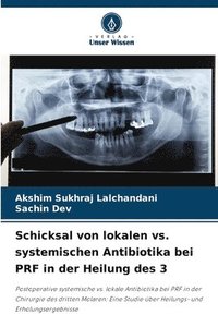 bokomslag Schicksal von lokalen vs. systemischen Antibiotika bei PRF in der Heilung des 3