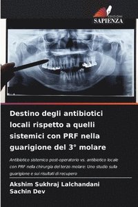 bokomslag Destino degli antibiotici locali rispetto a quelli sistemici con PRF nella guarigione del 3° molare