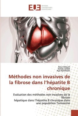 bokomslag Mthodes non invasives de la fibrose dans l'hpatite B chronique