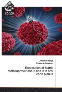 bokomslag Expression of Matrix Metalloproteinase 2 and 9 in oral lichen planus