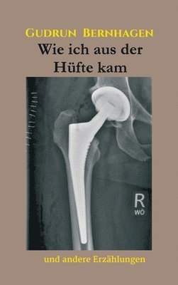 bokomslag Wie ich aus der Hüfte kam