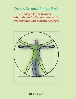 bokomslag Unnötige Operationen - Beispiele und Alternativen in der Orthopädie und Unfallchirurgie