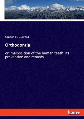 Simeon H Guilford, Simeon H. Guilford - Orthodontia, Häftad