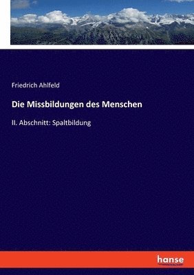 Die Missbildungen des Menschen 1