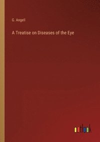 bokomslag A Treatise on Diseases of the Eye