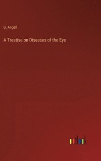 bokomslag A Treatise on Diseases of the Eye